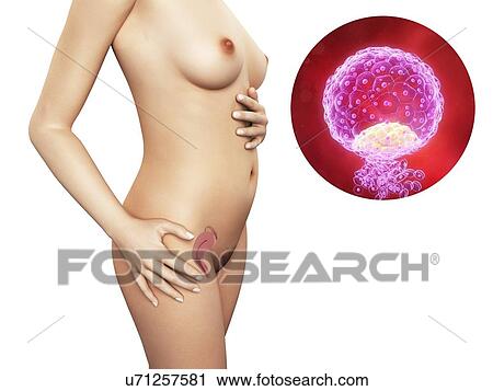 Pregnancy - implanted blastocyst, artwork View Large Illustration Clip Art - Pregnancy - implanted blastocyst, artwork. Fotosearch