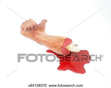 Clipart - Severed arm, artwork. Fotosearch