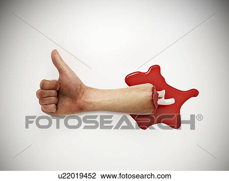 Drawing - Severed arm, artwork. Fotosearch