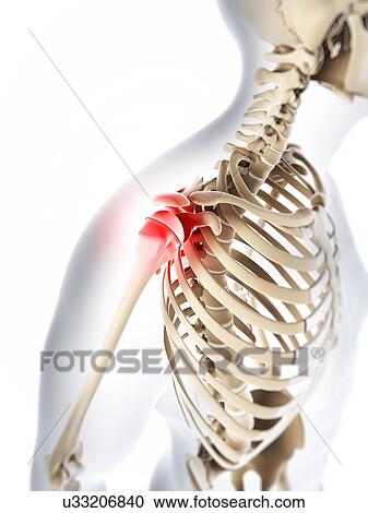 Shoulder pain, conceptual artwork View Large Illustration Clipart - Shoulder pain, conceptual artwork. Fotosearch