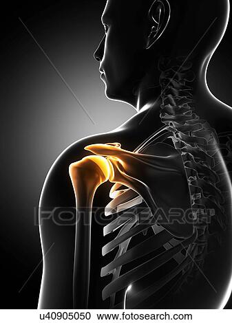Shoulder pain, conceptual artwork View Large Illustration Clipart - Shoulder pain, conceptual artwork. Fotosearch