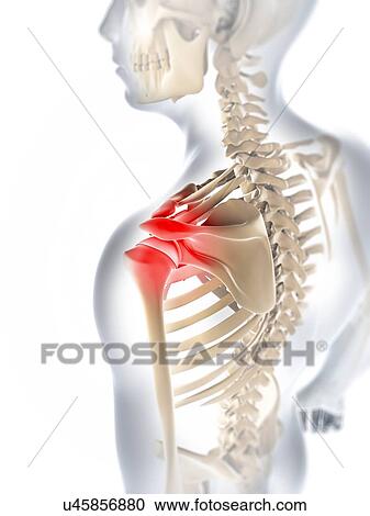 Shoulder pain, conceptual artwork View Large Illustration Clipart - Shoulder pain, conceptual artwork. Fotosearch