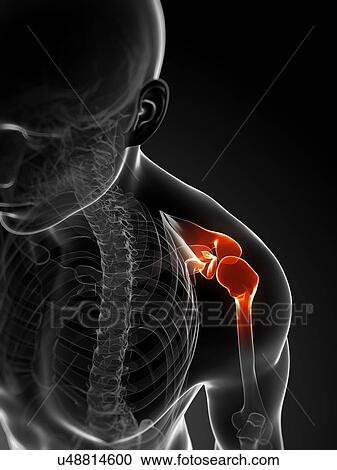 Shoulder pain, conceptual artwork View Large Illustration Clipart - Shoulder pain, conceptual artwork. Fotosearch