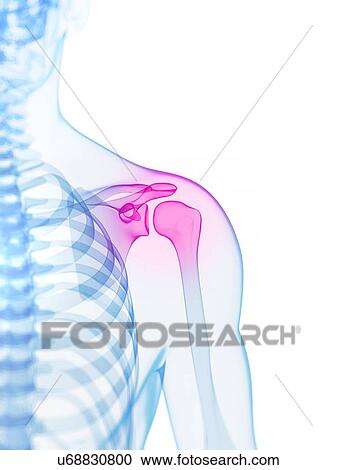 Shoulder pain, conceptual artwork View Large Illustration Clipart - Shoulder pain, conceptual artwork. Fotosearch
