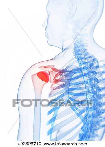 Shoulder pain, conceptual artwork View Large Illustration Clipart - Shoulder pain, conceptual artwork. Fotosearch