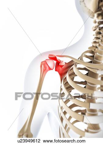 Shoulder pain, conceptual artwork View Large Illustration Drawing - Shoulder pain, conceptual artwork. Fotosearch