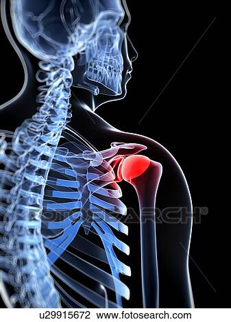 Drawing - Shoulder pain, conceptual artwork. Fotosearch