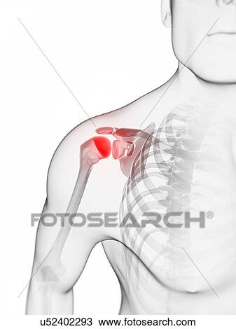 Shoulder pain, conceptual artwork View Large Illustration Drawing - Shoulder pain, conceptual artwork. Fotosearch