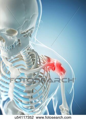 Shoulder pain, conceptual artwork View Large Illustration Drawing - Shoulder pain, conceptual artwork. Fotosearch
