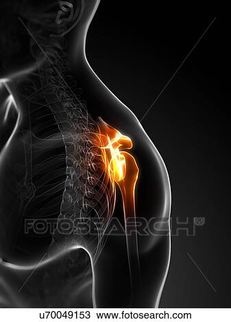 Shoulder pain, conceptual artwork View Large Illustration Drawing - Shoulder pain, conceptual artwork. Fotosearch