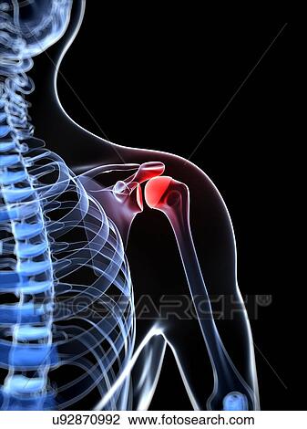 Shoulder pain, conceptual artwork View Large Illustration Drawing - Shoulder pain, conceptual artwork. Fotosearch