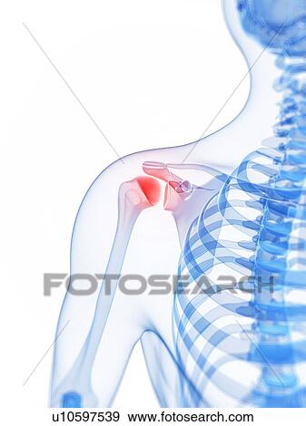 Shoulder pain, conceptual artwork View Large Illustration Stock Illustration - Shoulder pain, conceptual artwork. Fotosearch