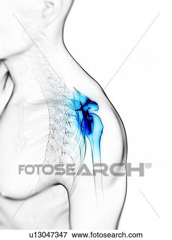 Stock Illustration - Shoulder pain, conceptual artwork. Fotosearch