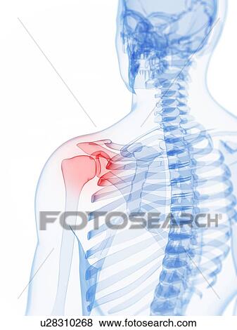 Shoulder pain, conceptual artwork View Large Illustration Stock Illustration - Shoulder pain, conceptual artwork. Fotosearch