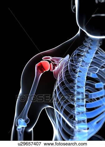 Shoulder pain, conceptual artwork View Large Illustration Stock Illustration - Shoulder pain, conceptual artwork. Fotosearch