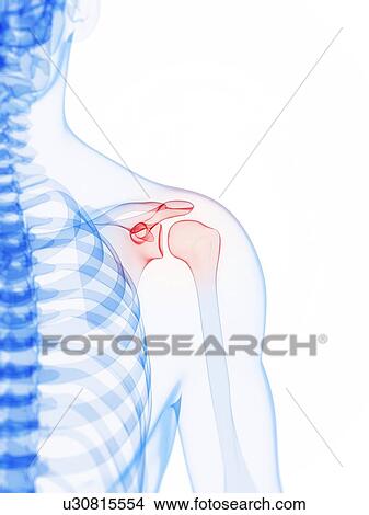 Shoulder pain, conceptual artwork View Large Illustration Stock Illustration - Shoulder pain, conceptual artwork. Fotosearch