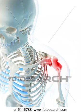 Shoulder pain, conceptual artwork View Large Illustration Stock Illustration - Shoulder pain, conceptual artwork. Fotosearch