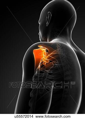 Shoulder pain, conceptual artwork View Large Illustration Stock Illustration - Shoulder pain, conceptual artwork. Fotosearch