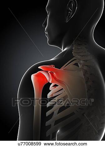 Shoulder pain, conceptual artwork View Large Illustration Stock Illustration - Shoulder pain, conceptual artwork. Fotosearch