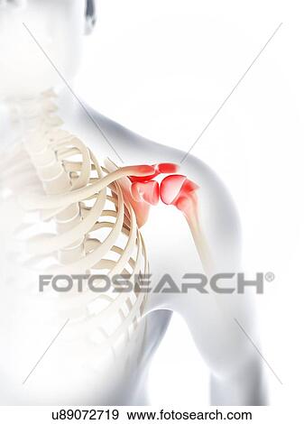 Shoulder pain, conceptual artwork View Large Illustration Stock Illustration - Shoulder pain, conceptual artwork. Fotosearch