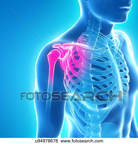Shoulder pain, conceptual artwork View Large Illustration Stock Illustration - Shoulder pain, conceptual artwork. Fotosearch