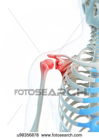 Shoulder pain, conceptual artwork View Large Illustration Stock Illustration - Shoulder pain, conceptual artwork. Fotosearch
