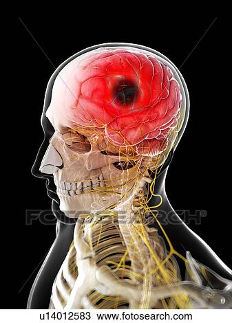 Stroke, artwork View Large Illustration Drawing - Stroke, artwork. Fotosearch