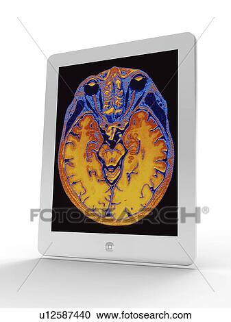 Clipart - Tablet computer showing MRI brain scan. Fotosearch