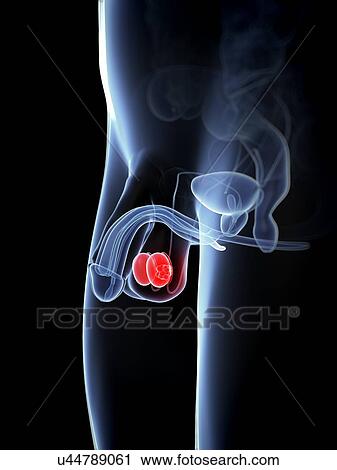Testicular cancer, artwork View Large Illustration Clip Art - Testicular cancer, artwork. Fotosearch