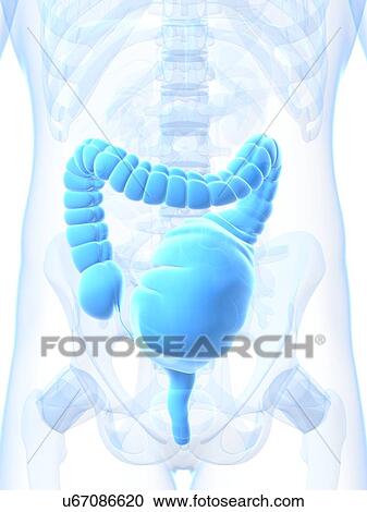 Clipart - Toxic megacolon, artwork. Fotosearch