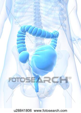 Toxic megacolon, artwork View Large Illustration Stock Illustration - Toxic megacolon, artwork. Fotosearch