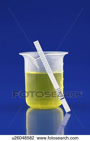Drawing - Urine test. Fotosearch