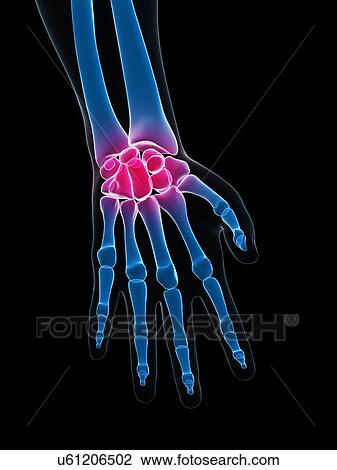 Wrist pain, conceptual artwork View Large Illustration Drawing - Wrist pain, conceptual artwork. Fotosearch