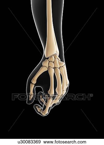 Stock Illustration - Wrist pain, conceptual artwork. Fotosearch