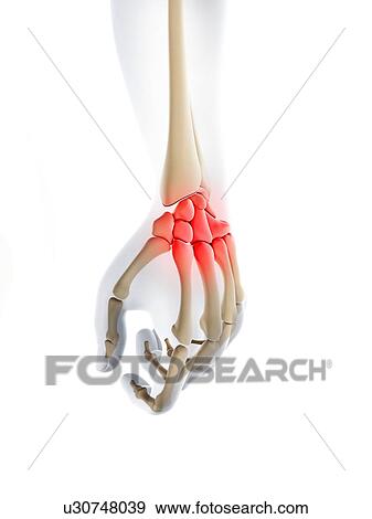 Wrist pain, conceptual artwork View Large Illustration Stock Illustration - Wrist pain, conceptual artwork. Fotosearch