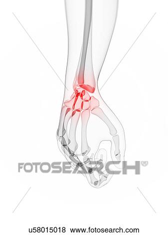 Wrist pain, conceptual artwork View Large Illustration Stock Illustration - Wrist pain, conceptual artwork. Fotosearch