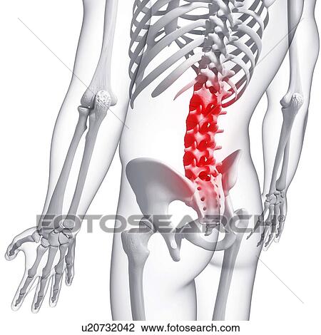 Back pain, artwork View Large Illustration Drawing - Back pain, artwork. Fotosearch