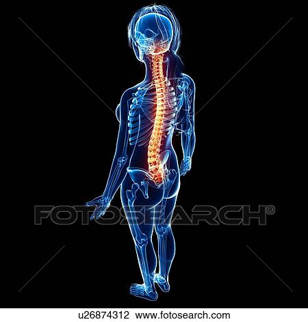 Back pain, artwork View Large Illustration Drawing - Back pain, artwork. Fotosearch