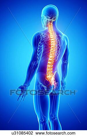 Drawing - Back pain, artwork. Fotosearch