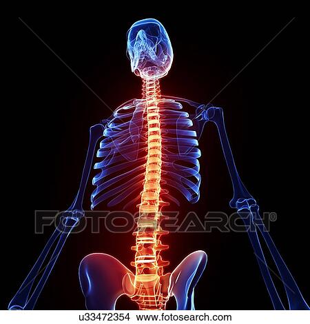 Stock Illustration - Back pain, artwork. Fotosearch