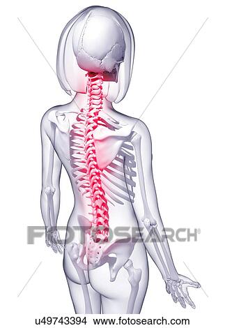 Back pain, artwork View Large Illustration Stock Illustration - Back pain, artwork. Fotosearch