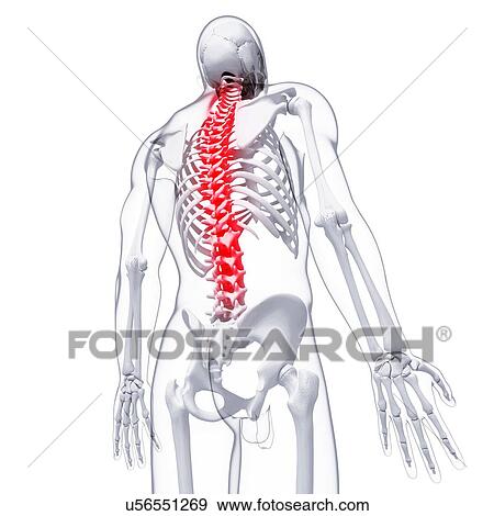 Stock Illustration - Back pain, artwork. Fotosearch