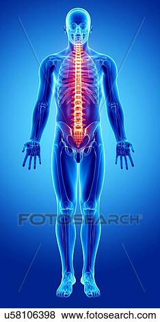 Back pain, artwork View Large Illustration Stock Illustration - Back pain, artwork. Fotosearch