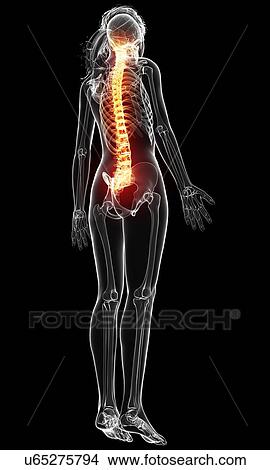 Stock Illustration - Back pain, artwork. Fotosearch