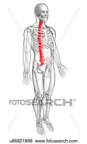 Stock Illustration - Back pain, artwork. Fotosearch