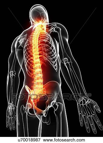 Back pain, artwork View Large Illustration Stock Illustration - Back pain, artwork. Fotosearch