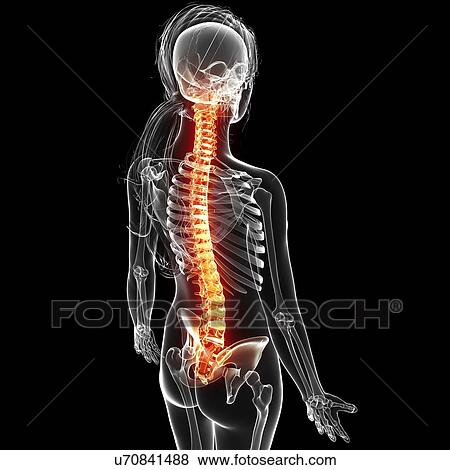 Back pain, artwork View Large Illustration Stock Illustration - Back pain, artwork. Fotosearch