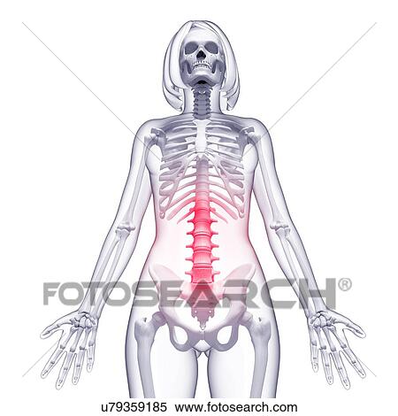 Back pain, artwork View Large Illustration Stock Illustration - Back pain, artwork. Fotosearch