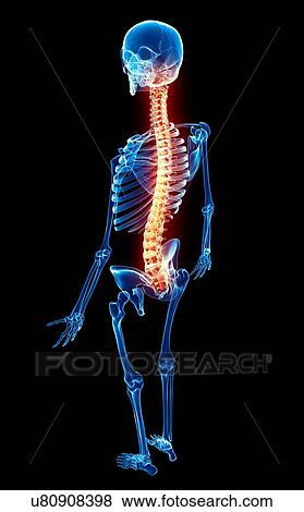 Stock Illustration - Back pain, artwork. Fotosearch