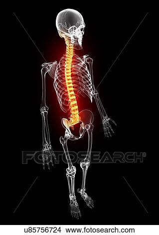Back pain, artwork View Large Illustration Stock Illustration - Back pain, artwork. Fotosearch